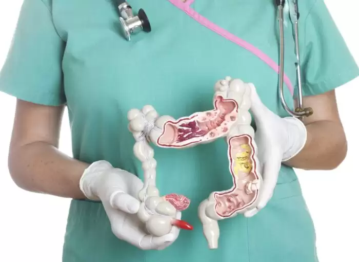 6 продуктів, які максимально погіршують проблеми з кишківником