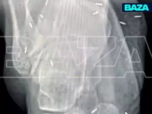 news-image