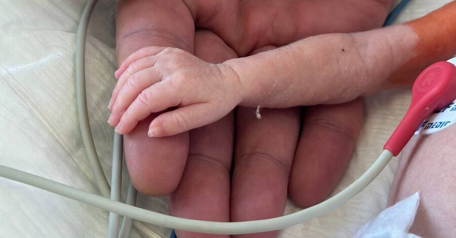 "Сердце размером с орешек" - в Институте сердца спасли младенца весом 1,1 кг