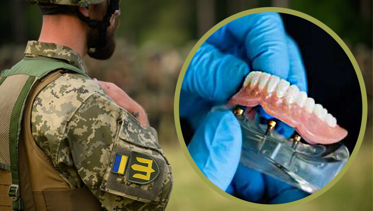Стало відомо, у яких лікарнях Рівненщини військовики зможуть безплатно протезувати зуби