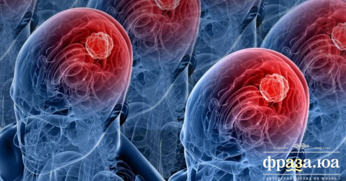 Итальянцы наконец-то выяснили, в чем же суть человеческого интеллекта