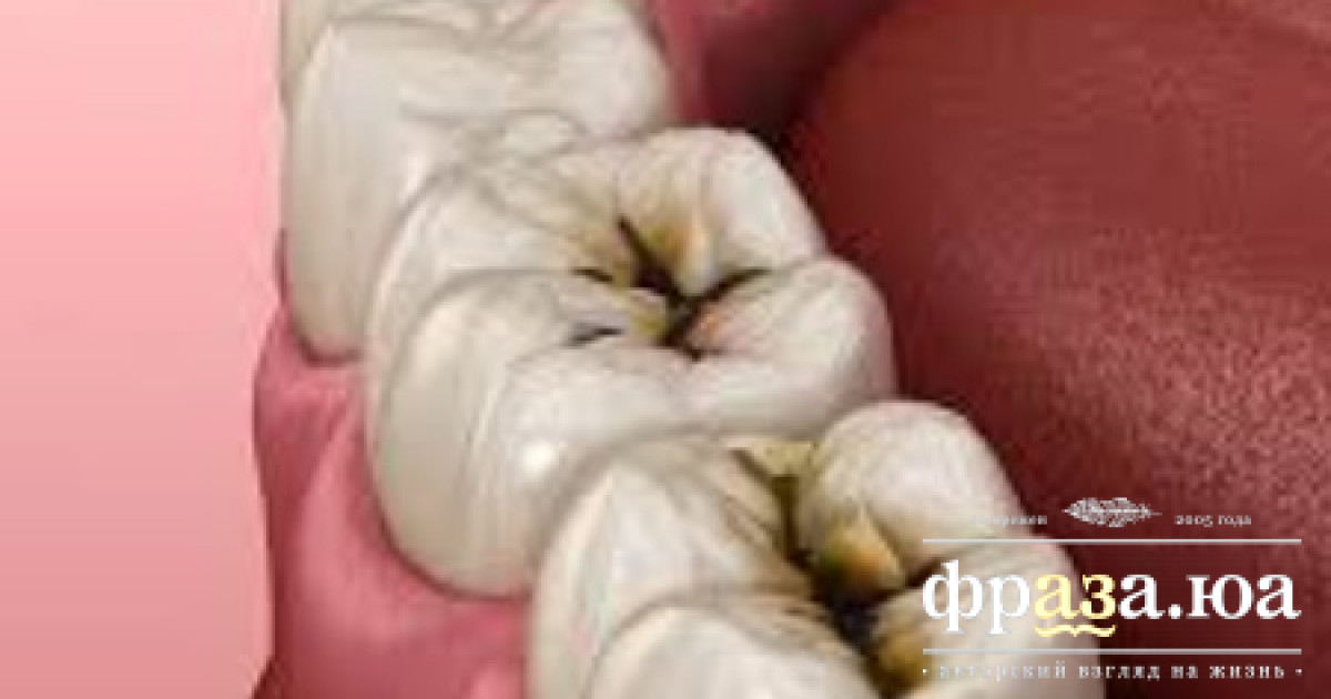 Американцы обнаружили новый способ предотвращения кариеса