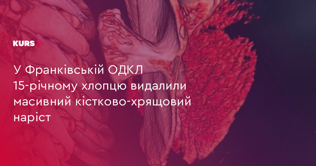 У Франківській ОДКЛ 15-річному хлопцю видалили масивний кістково-хрящовий наріст