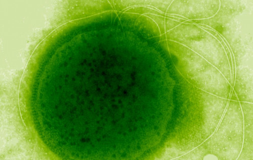 У морській безодні знайшли мікроорганізм, здатний вижити під дією смертельної радіації