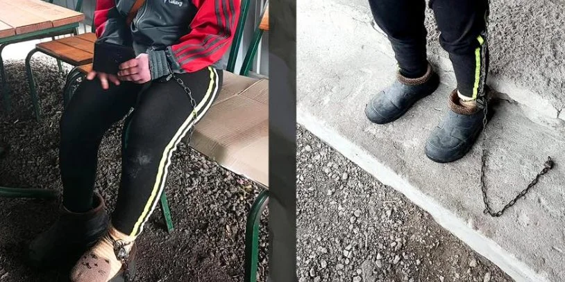 Стала известна судьба ребенка с инвалидностью, мать-воспитательница которого приковывала его цепями