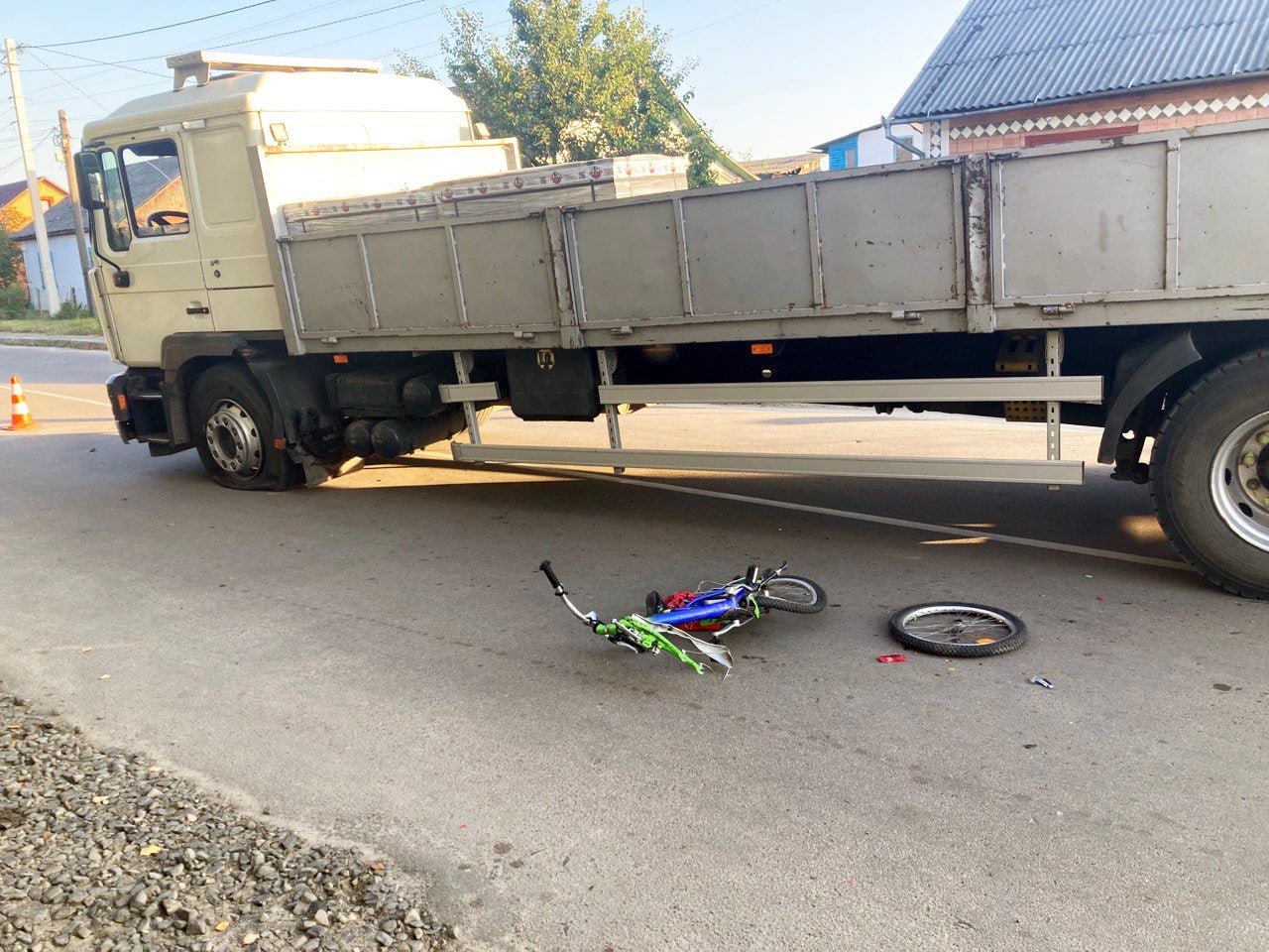 Перелом гомілки й ампутація зубів: волинянин вантажівкою наїхав на дитину