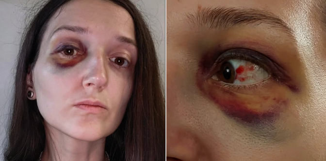 У Львові підліток побив жінку у трамваї та втік: зловмисника затримано