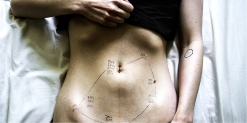 «Документалка» про ендометріоз отримала престижну премію