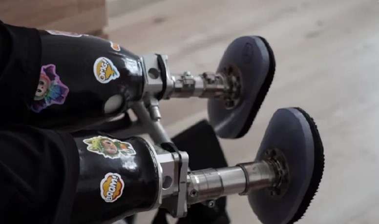 Він пережив 194 операції, лікарі не давали жодних надій: Олександр Безверхній вистояв