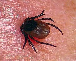 Що треба знати про хворобу Лайма