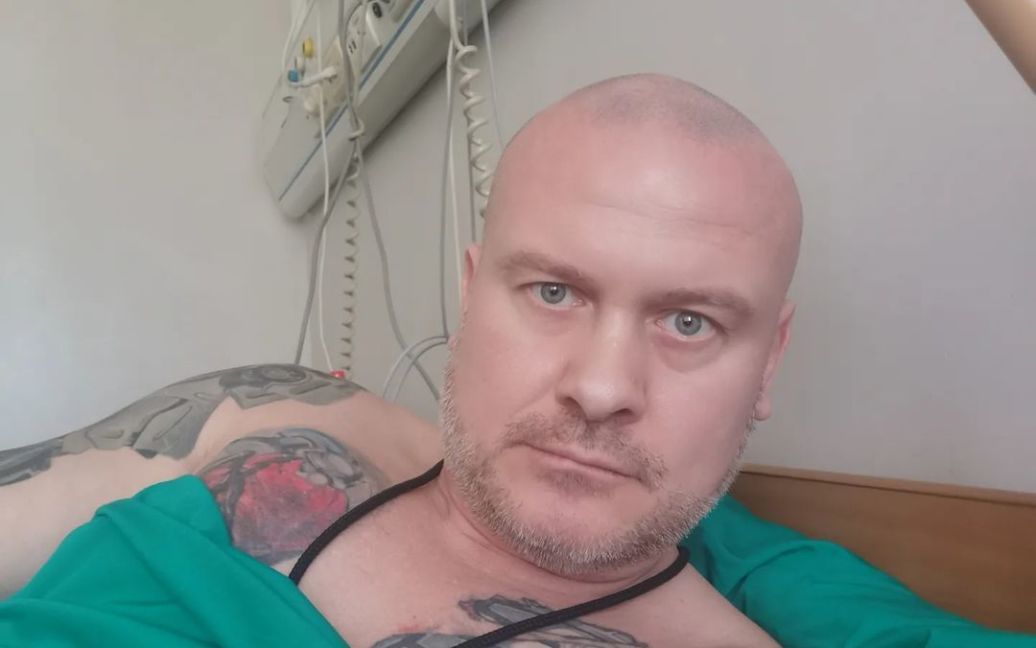 Сложная операция на сердце: похудевший Вячеслав Узелков поделился фото после больницы
