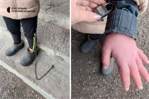 "Вона тікала і не знала, як повернутись": ексвихователька дитбудинку на Кіровоградщині про те, чому прив'язувала дитину