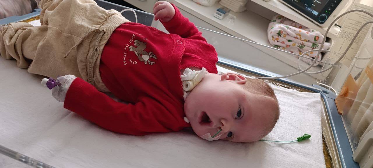 Кожен подих — боротьба: для немовляти з Коломиї збирають 86 тисяч грн на життєво необхідний апарат