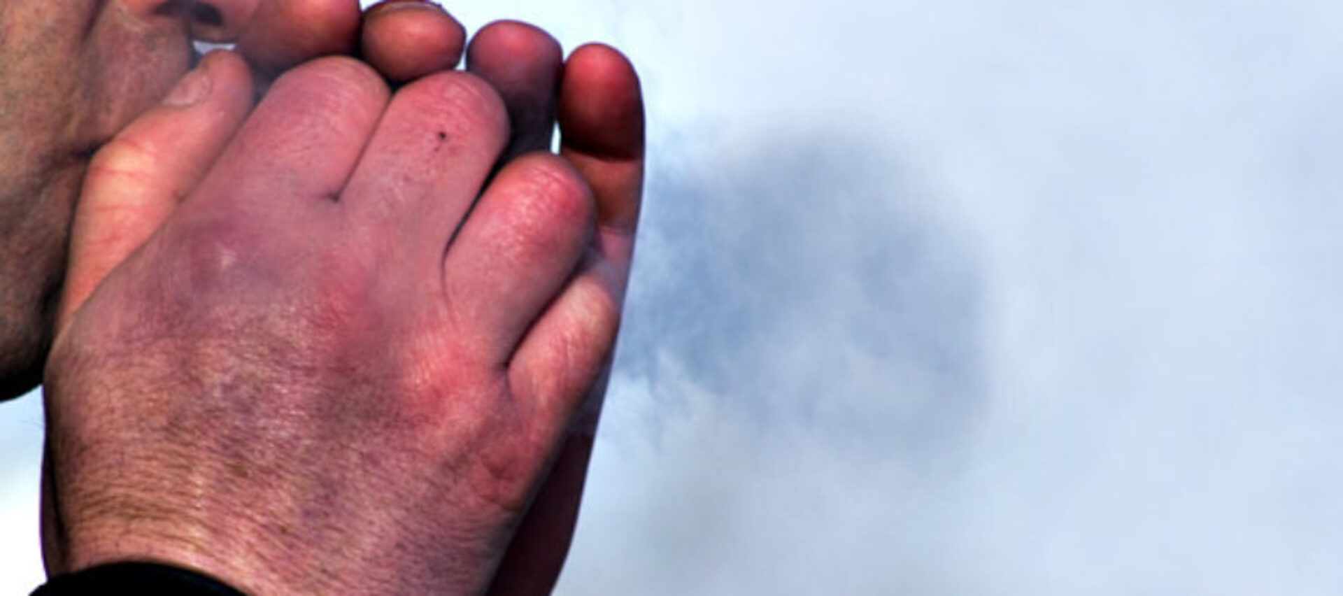 У Самборі до лікарні із переохолодженням потрапив літній чоловік