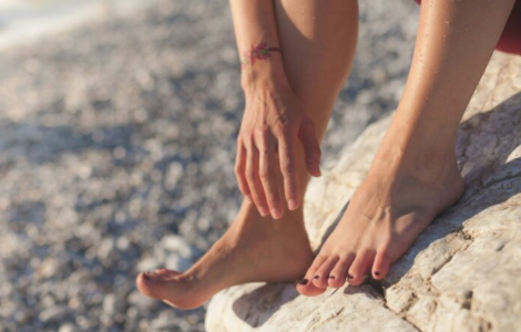 Чому виникає мікоз на ногах і як він проявляється