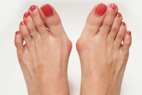 Взуття, котре збереже здоров'я ваших стоп