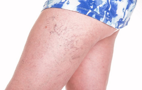 Кому категорично заборонено сидіти, схрестивши ноги