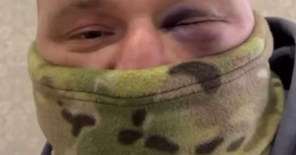 Справу про побиття ветерана співробітниками ТЦК у Харкові розслідує поліція