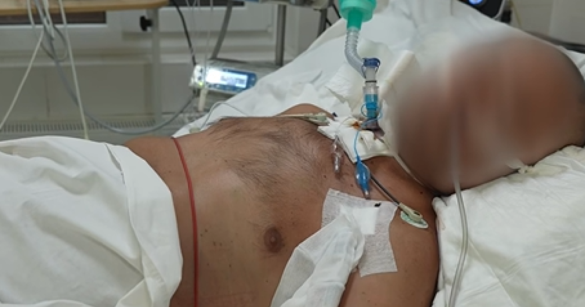 У Харкові врятували військового після клінічної смерті