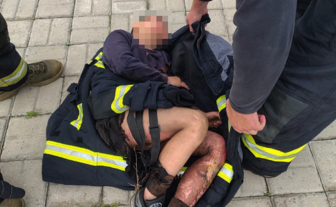 В Одесі підлітка вдарило струмом на даху вагона: хлопця відкинуло під поїзд (ФОТО)