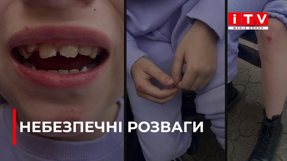 У дитини — струс мозку та вибиті зуби: деталі скандальної ситуації із самокатами у Рівному (ВІДЕО)