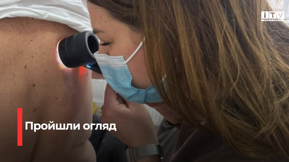 Під час виїзного огляду на Рівненщині виявили випадки раку шкіри