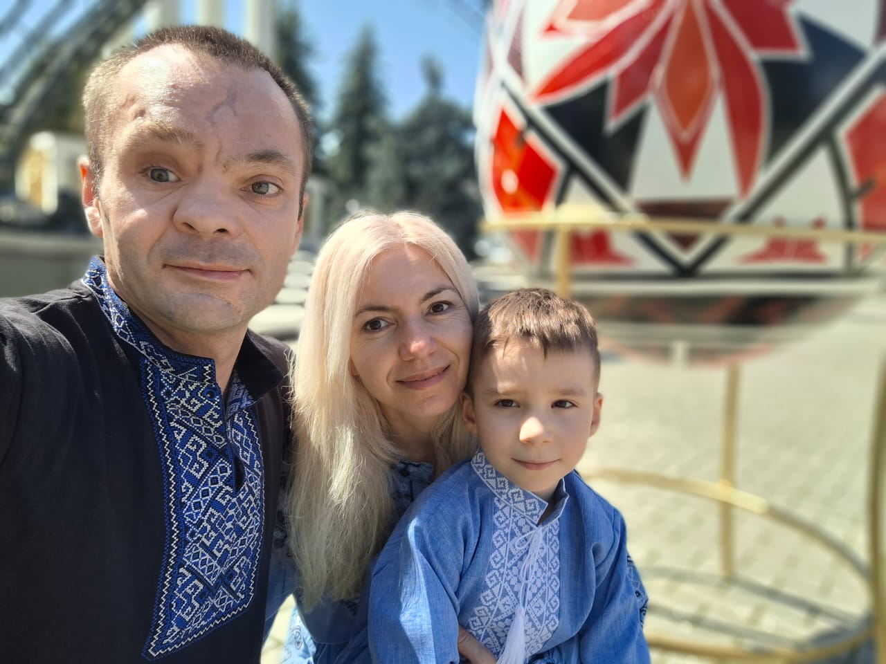 Міжнародна команда медиків відновили обличчя військового після атаки дрона (ФОТО)