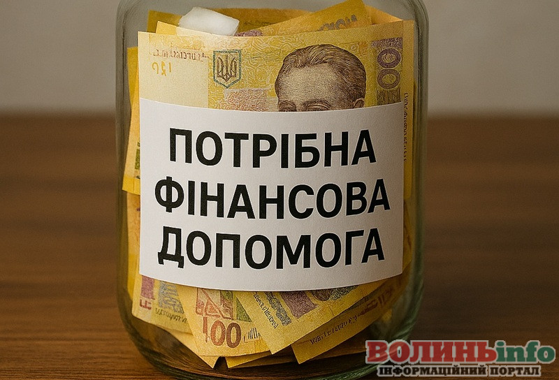 Потрібні кошти на реабілітацію: жінка та 2-річна дитина опинилися в реанімації через пожежу