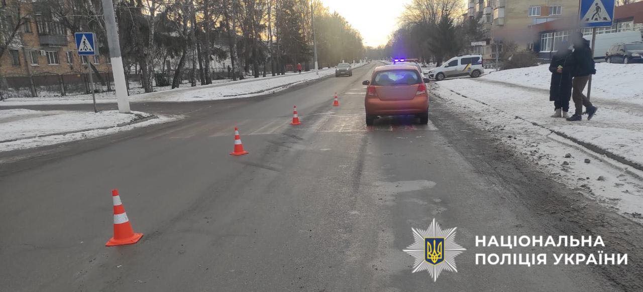 На Київщині легковик під кермуванням жінки травмував пенсіонерку на пішохідному переході