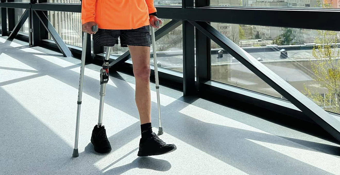 Як правильно спілкуватися з людьми без кінцівки або з протезом