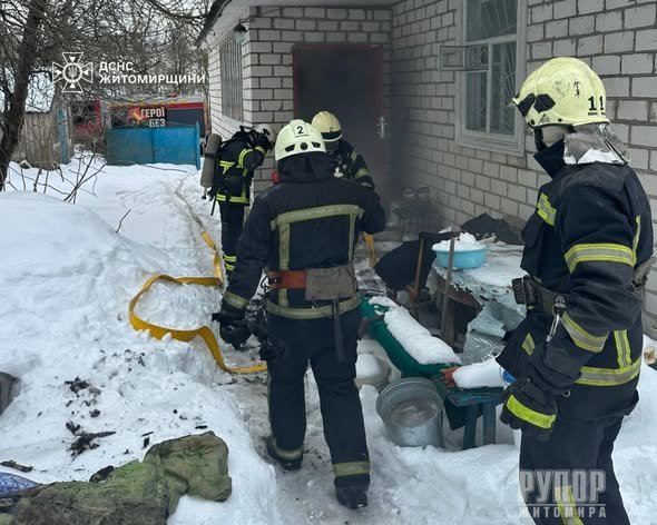 У Житомирському районі під час пожежі в приватній оселі травмувалася жінка
