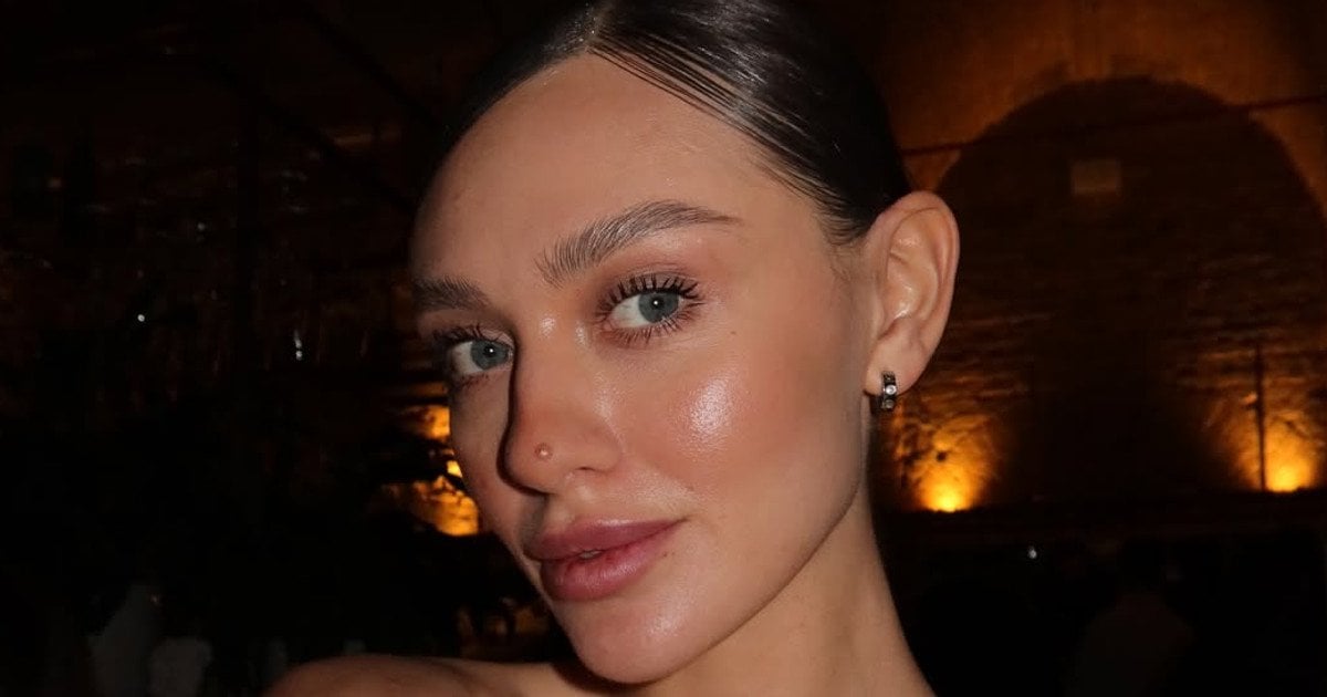 Переможниця "Холостяка" Надін шокувала серйозними проблемами зі здоров'ям просто на початку шоу