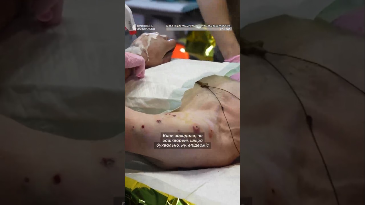 "Хлопці підсмажилися": прилетів "шахед" у хату #shorts