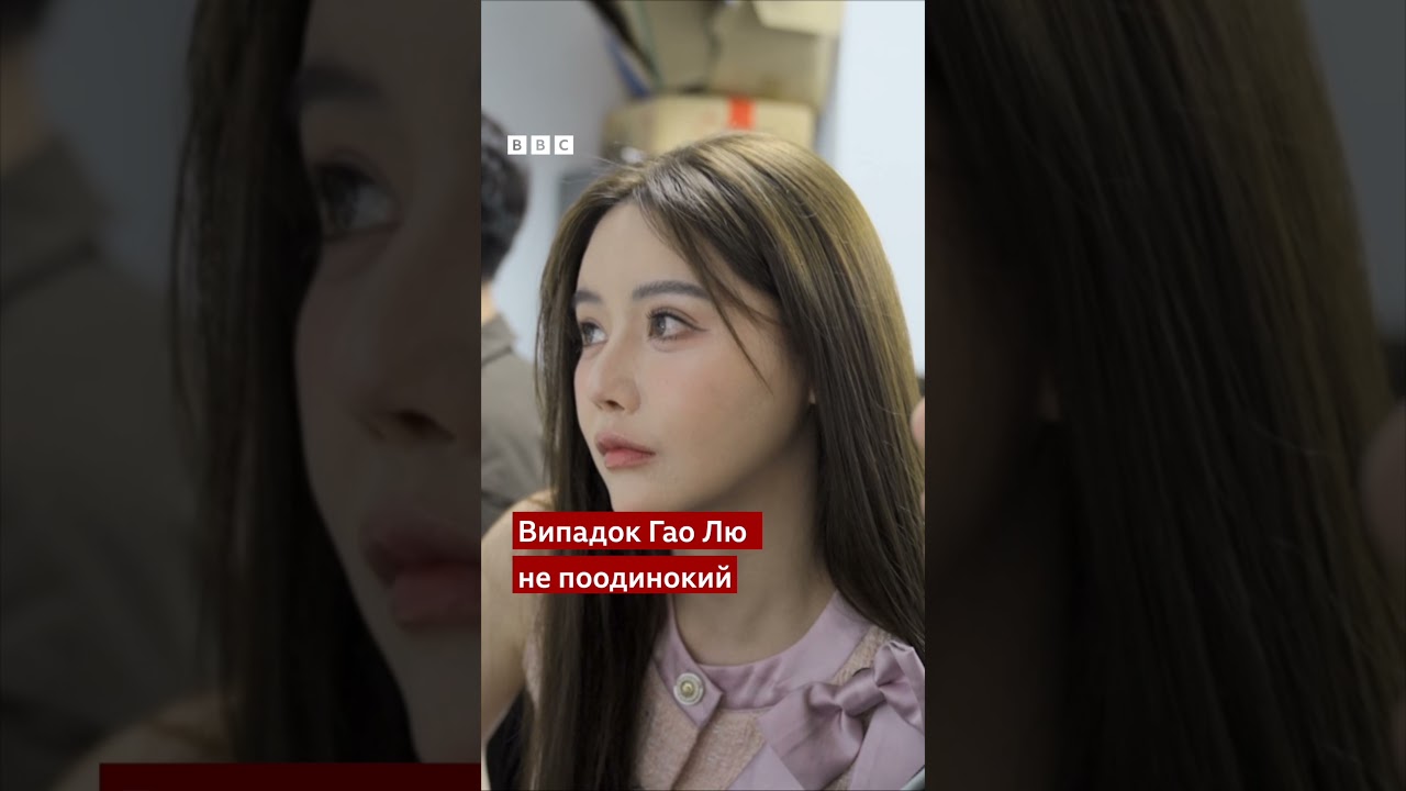 Після невдалої пластичної операції кінчик носа китайської актриси почорнів #shorts #китай #краса