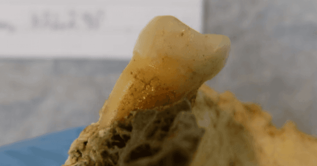 В зубах человека, останкам которого 4000 лет, обнаружили бактерии, вызывающие кариес