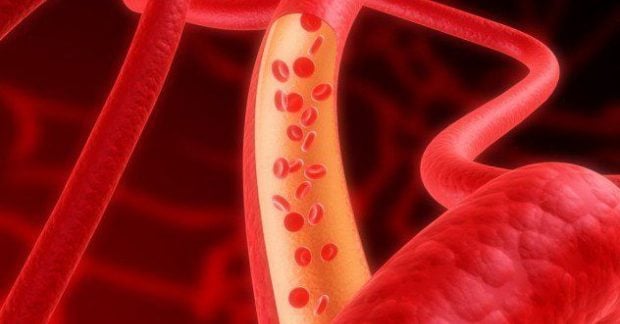 3D-печатные кровеносные сосуды могут улучшить результаты шунтирования сердца