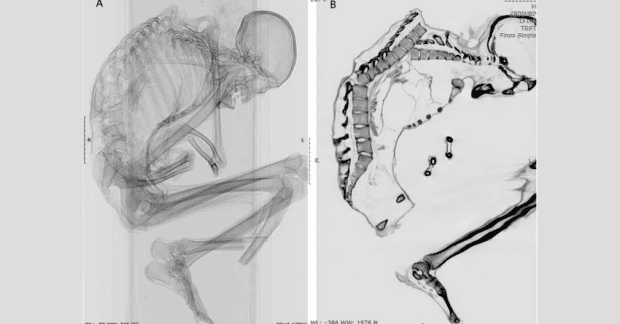 Ученые нашли мумию мужчины, умершего в результате несчастного случая на шахте более тысячи лет назад