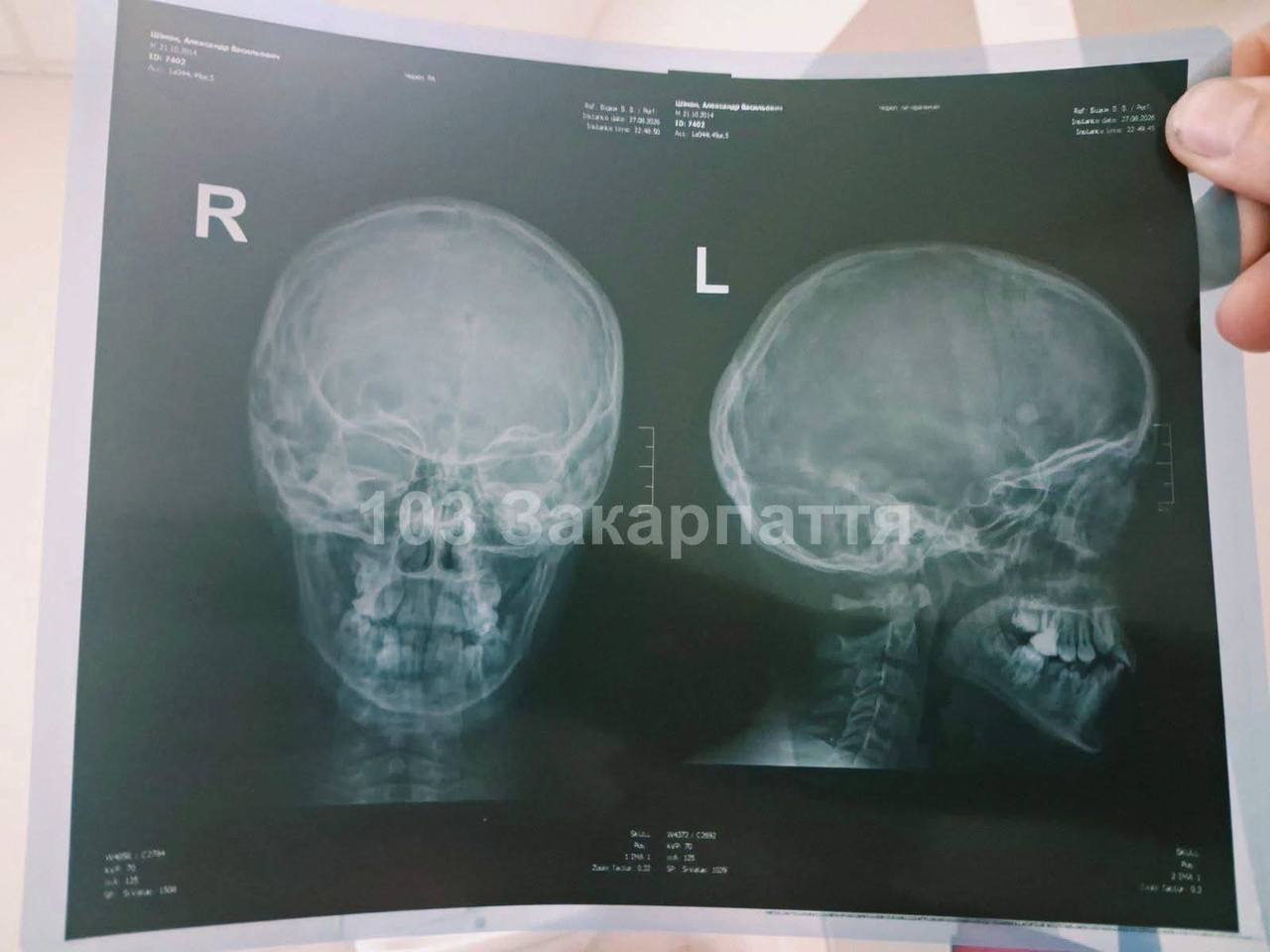 news-image